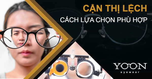 Thế Nào Là Bị Cận Thị Lệch? Cách Lựa Chọn Kính Mắt Cho Người Bị Cận Lệch