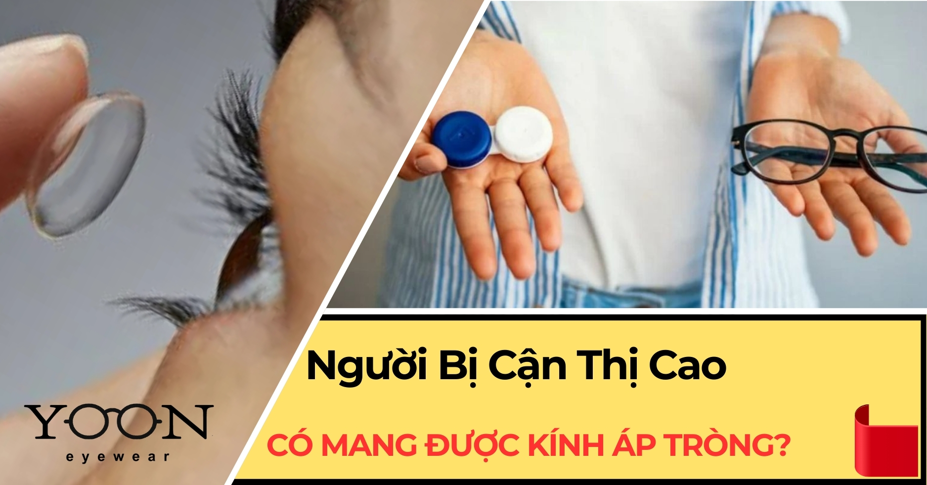 Cận Cao Có Mang Được Kính Áp Tròng Không?
