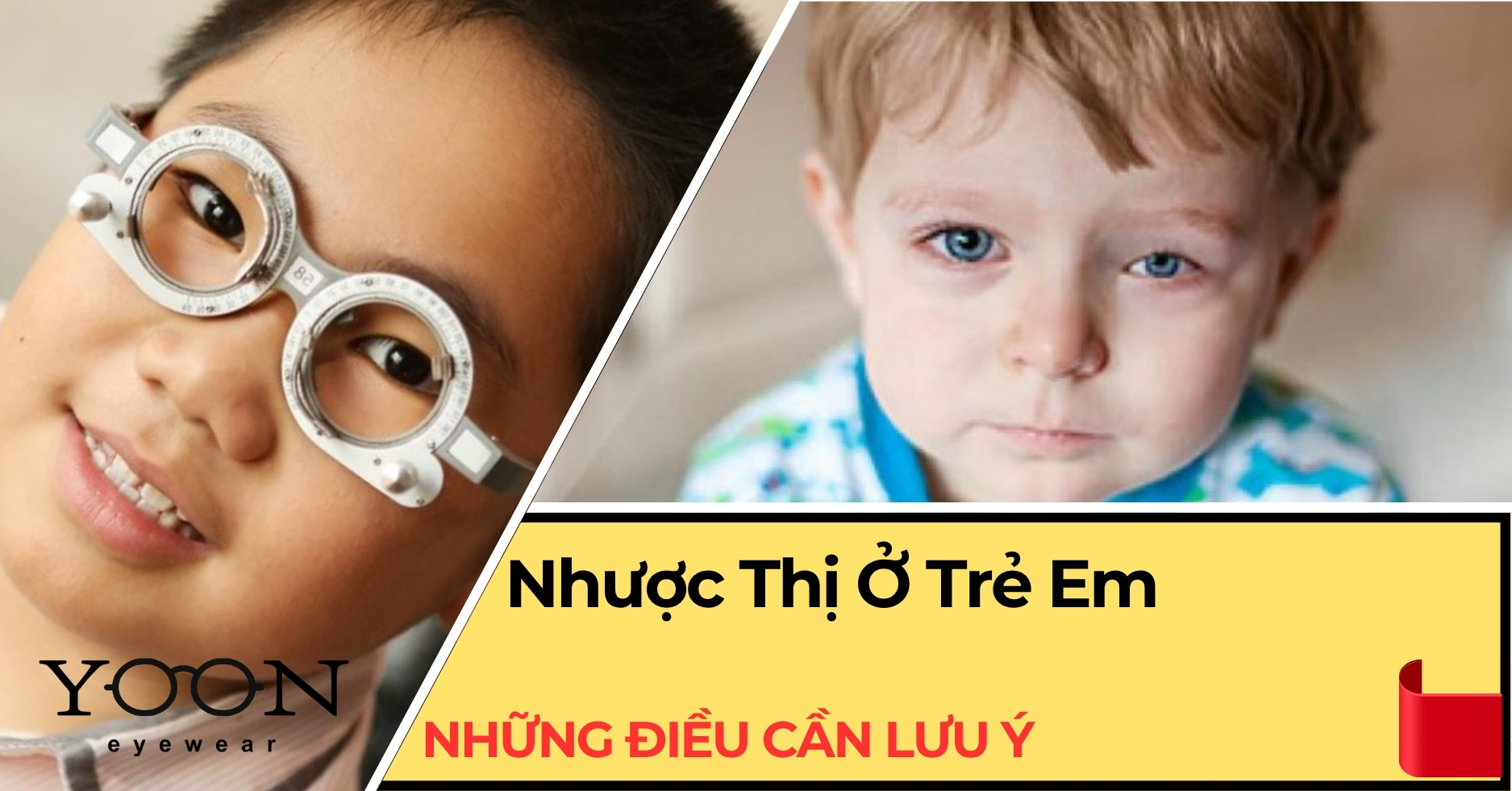 Cảnh Báo Nhược Thị Ở Trẻ Em: Đừng Chủ Quan!