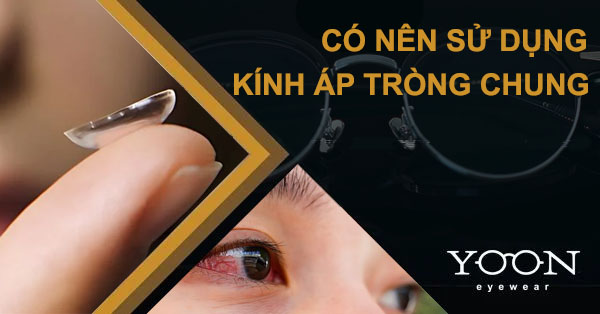 Việc Sử Dụng Chung Kính Áp Tròng Với Nhau Có Ảnh Hưởng Tới Mắt Không?