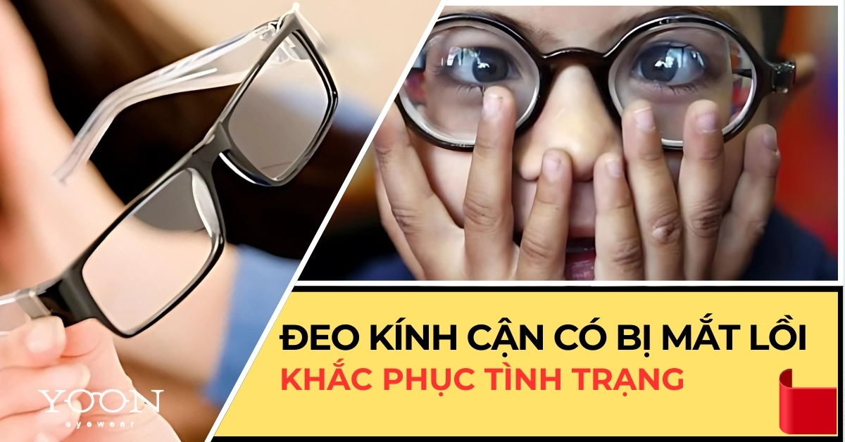 Đeo Kính Cận Có Bị Lồi Mắt Không?