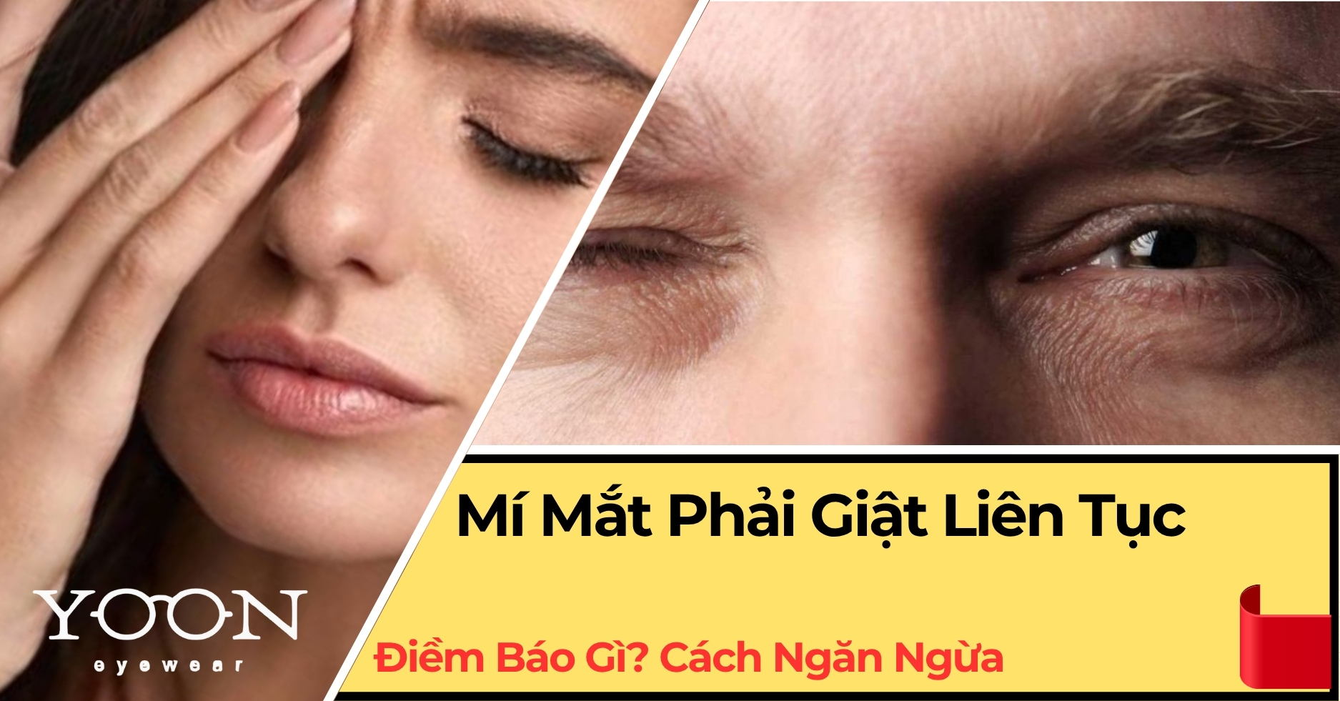 Giải Thích Hiện Tượng Mí Mắt Phải Giật Liên Tục – Điềm Báo Gì?