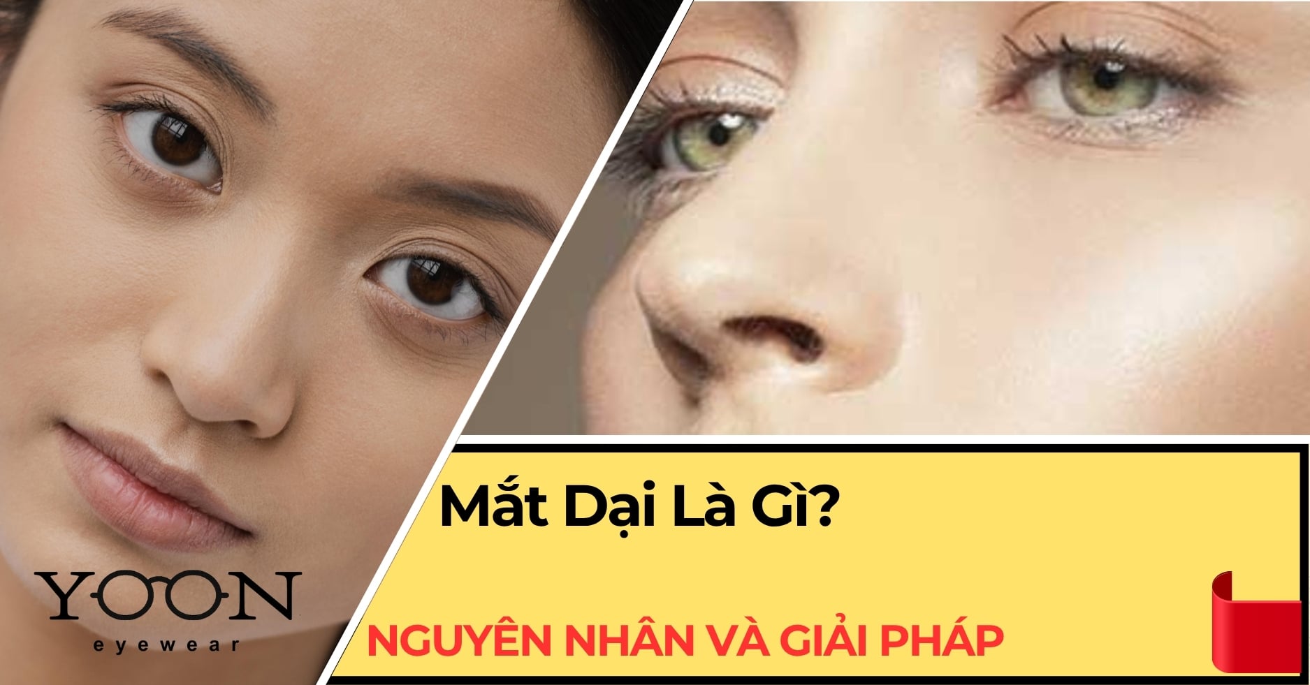 Khi Đôi Mắt Không Còn Biết Cười: Mắt Dại Là Gì?