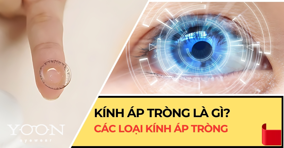 Kính Áp Tròng (Lens Cận) Là Gì?