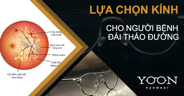 Cách Chọn Mắt Kính Phù Hợp Cho Người Bị Bệnh Đái Tháo Đường