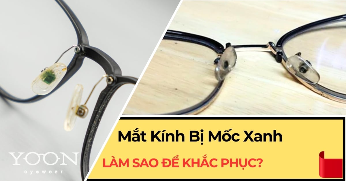 Mắt Kính Bị Mốc Xanh Phải Làm Sao?