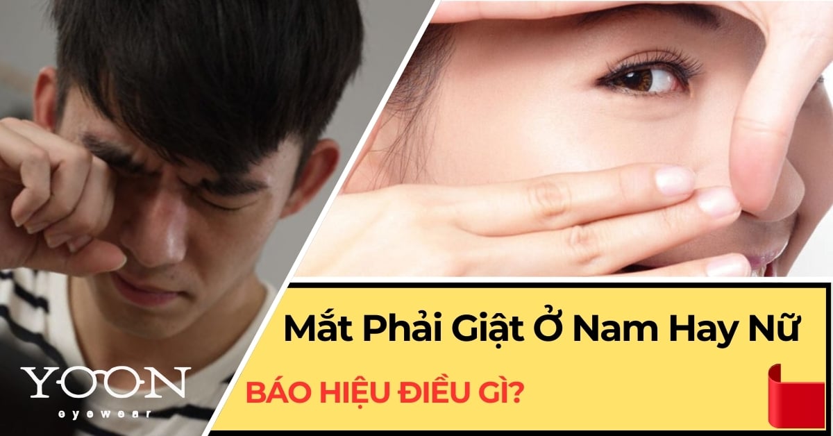 Mắt Phải Giật Ở Nam Và Nữ Báo Hiệu Điều Gì?