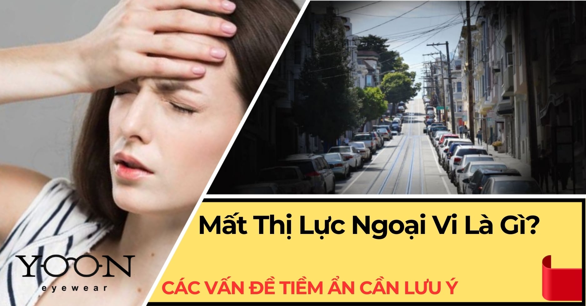 Mất Thị Lực Ngoại Vi Là Gì? Các Vấn Đề Tiềm Ẩn Cần Lưu Ý