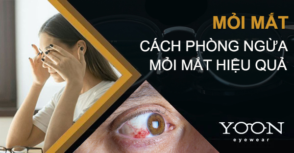 Mỏi Mắt - Cách Phòng Ngừa Mỏi Mắt Hiệu Quả