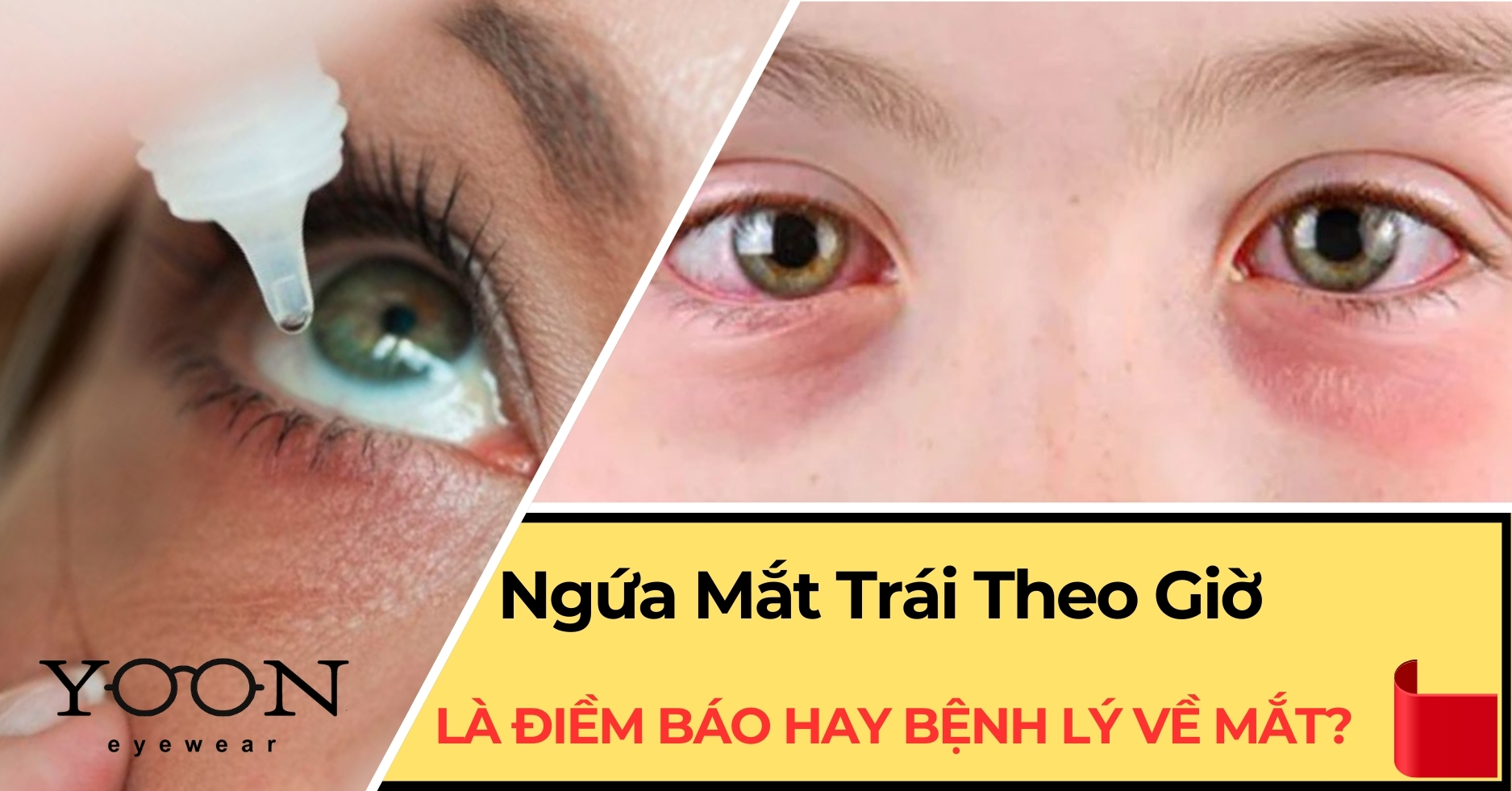 Ngứa Mắt Trái Theo Giờ Là Điềm Báo Gì?