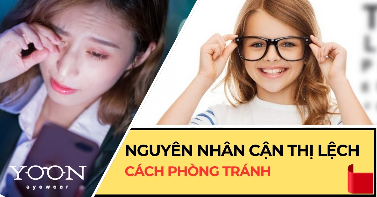 Nguyên Nhân Và Cách Chữa Cận Thị Lệch Độ