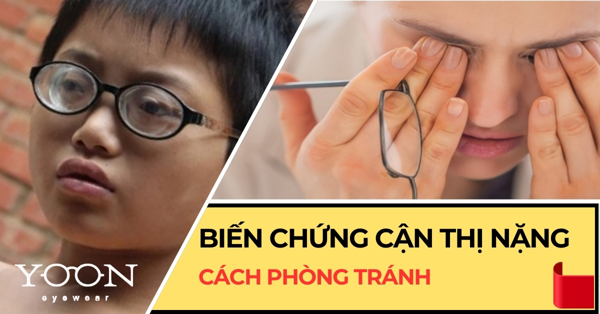 Những Biến Chứng Của Cận Thị Nặng Và Cách Phòng Ngừa?