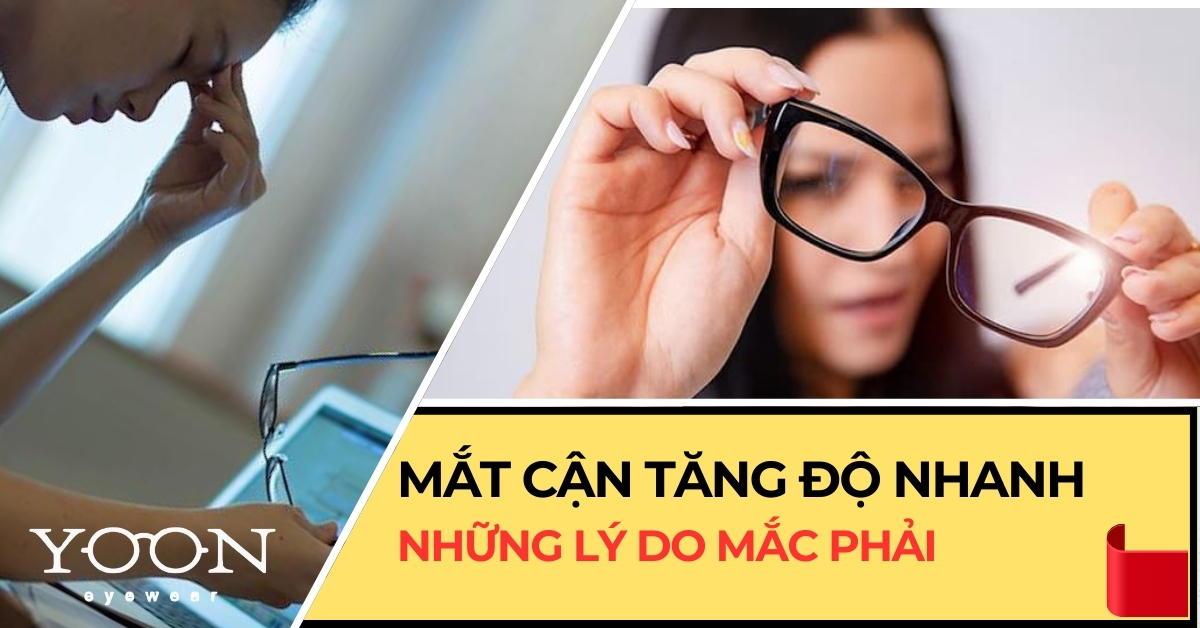 Những Lý Do Khiến Mắt Cận Thị Bị Tăng Độ Nhanh
