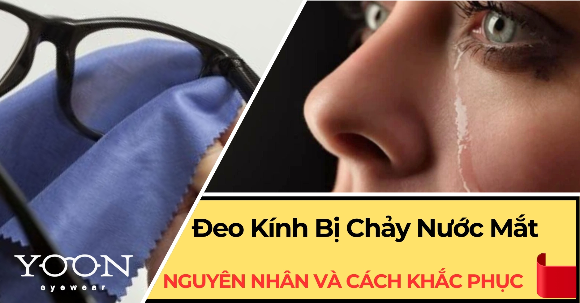 Tại Sao Đeo Kính Bị Chảy Nước Mắt? Nguyên Nhân Và Cách Khắc Phục?