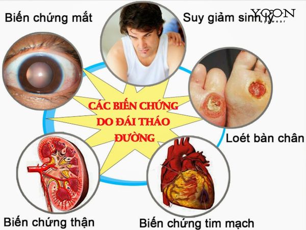 BỆNH ĐÁI THÁO ĐƯỜNG LÀ GÌ?