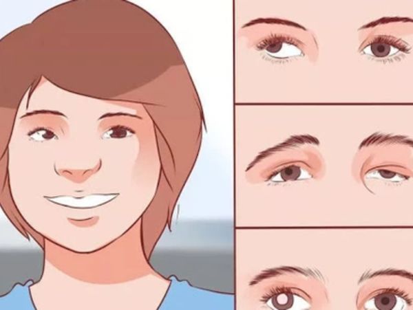 CÁC TRIỆU CHỨNG CỦA NHƯỢC THỊ