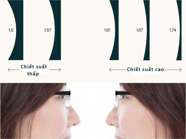 KHI NÀO NÊN CHỌN TRÒNG CHIẾT SUẤT THẤP ?