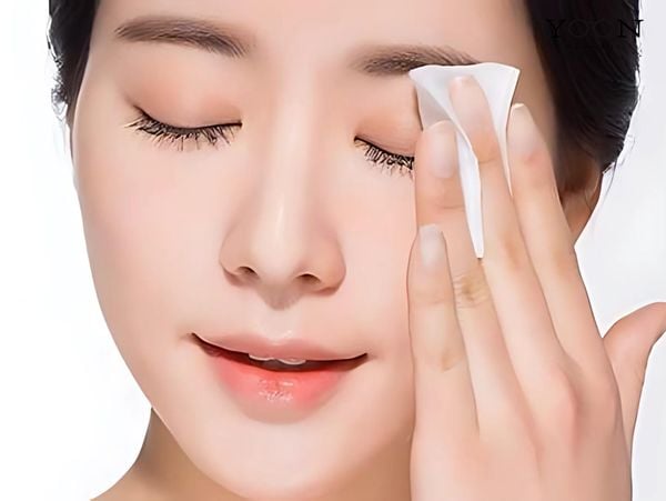 LÀM THẾ NÀO ĐỂ KIỂM SOÁT TÌNH TRẠNG CHẮP MẮT?
