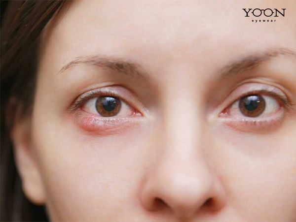 LÀM THẾ NÀO NHẬN BIẾT MÌNH BỊ CƯỜM NƯỚC?