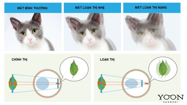 LOẠN&nbsp;THỊ&nbsp;LÀ&nbsp;GÌ