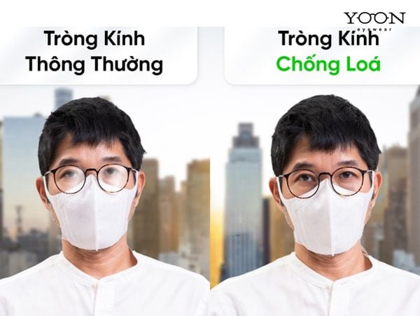 TRÒNG CHỐNG CHÓI DÀNH CHO AI?