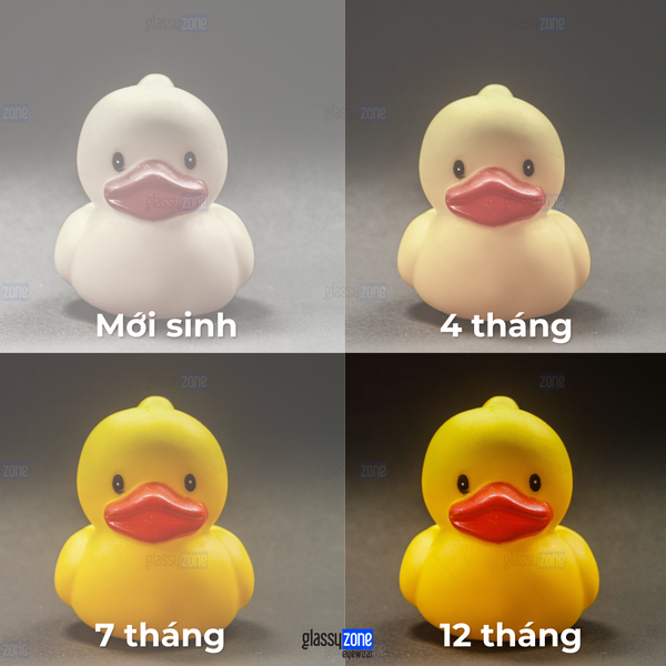 thị giác trẻ