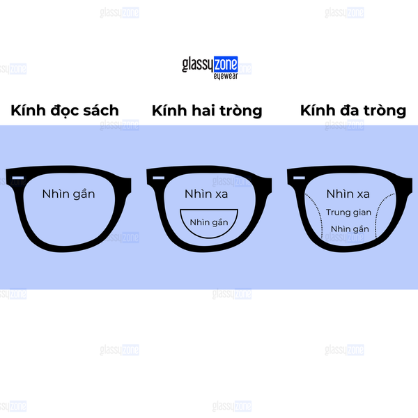 kiểm soát cận thị