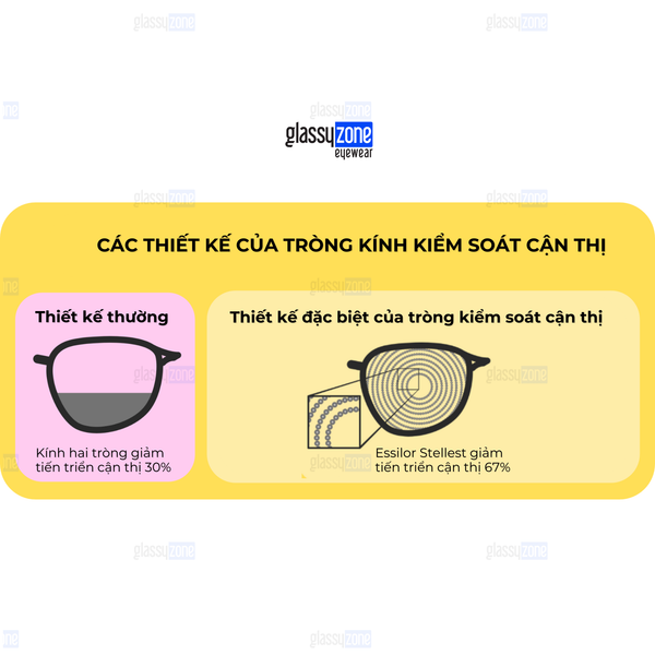 kiểm soát cận thị