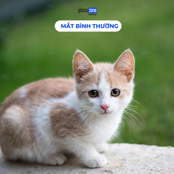 Đục thủy tinh thể