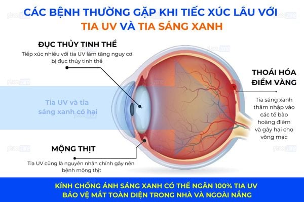 tròng kính chống ánh sáng xanh