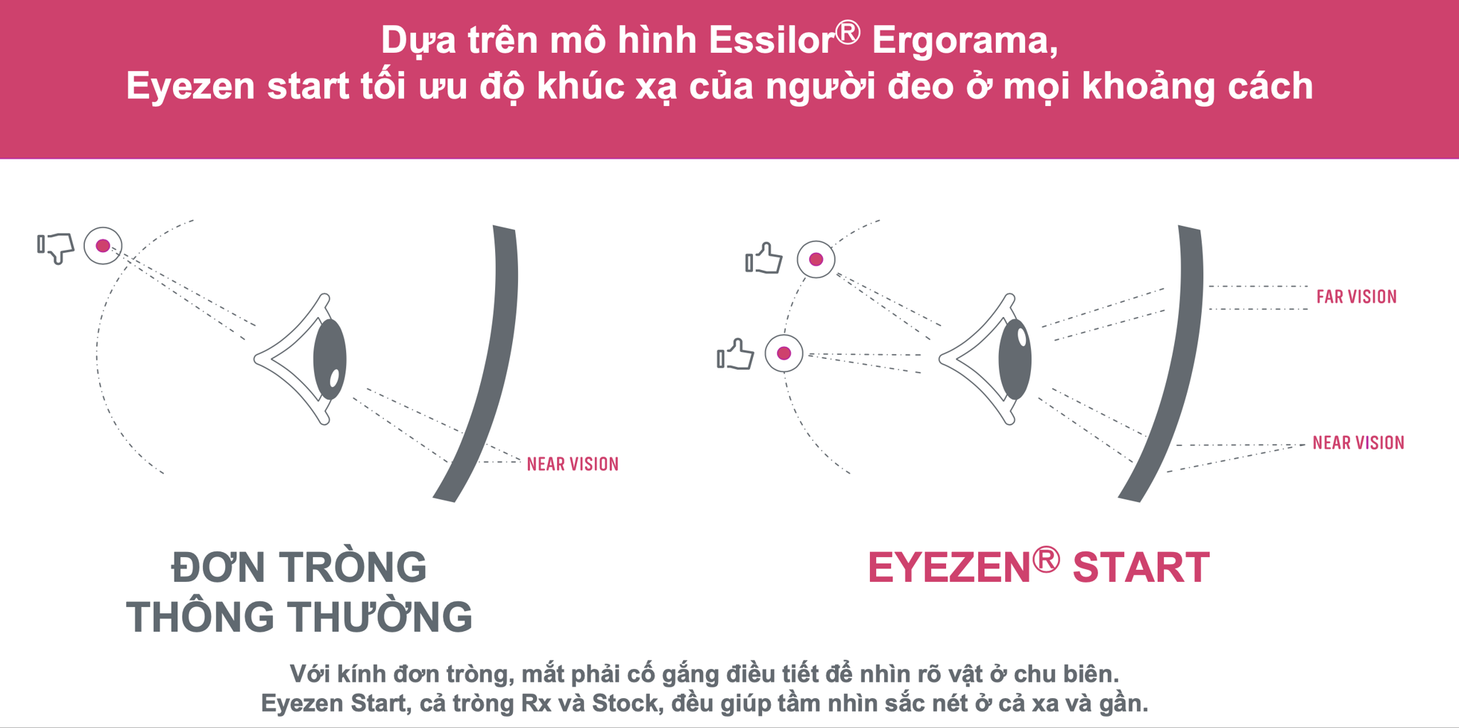 trong-kinh-thu-gian-mat-essilor-eyezen-160
