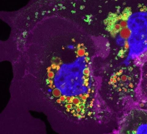 Sinh học không gian (Spatial Biology) - Xu hướng mới trong nghiên cứu y sinh