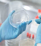 Thử nghiệm độ nhiễm khuẩn (Bioburden)