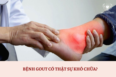 BỆNH GOUT = PURIN > URAT > AXIT URIC THÔI MÀ! CÓ GÌ ĐÂU MÀ CÁC ANH BẢO KHÓ CHỮA? ĂN THEO MINH TÂM ĐỨC ÍT THÁNG LÀ BÁI BAI AXIT URIC - GOUT NGAY   ⬇️ CHI TIẾT PHÂN TÍCH⬇️