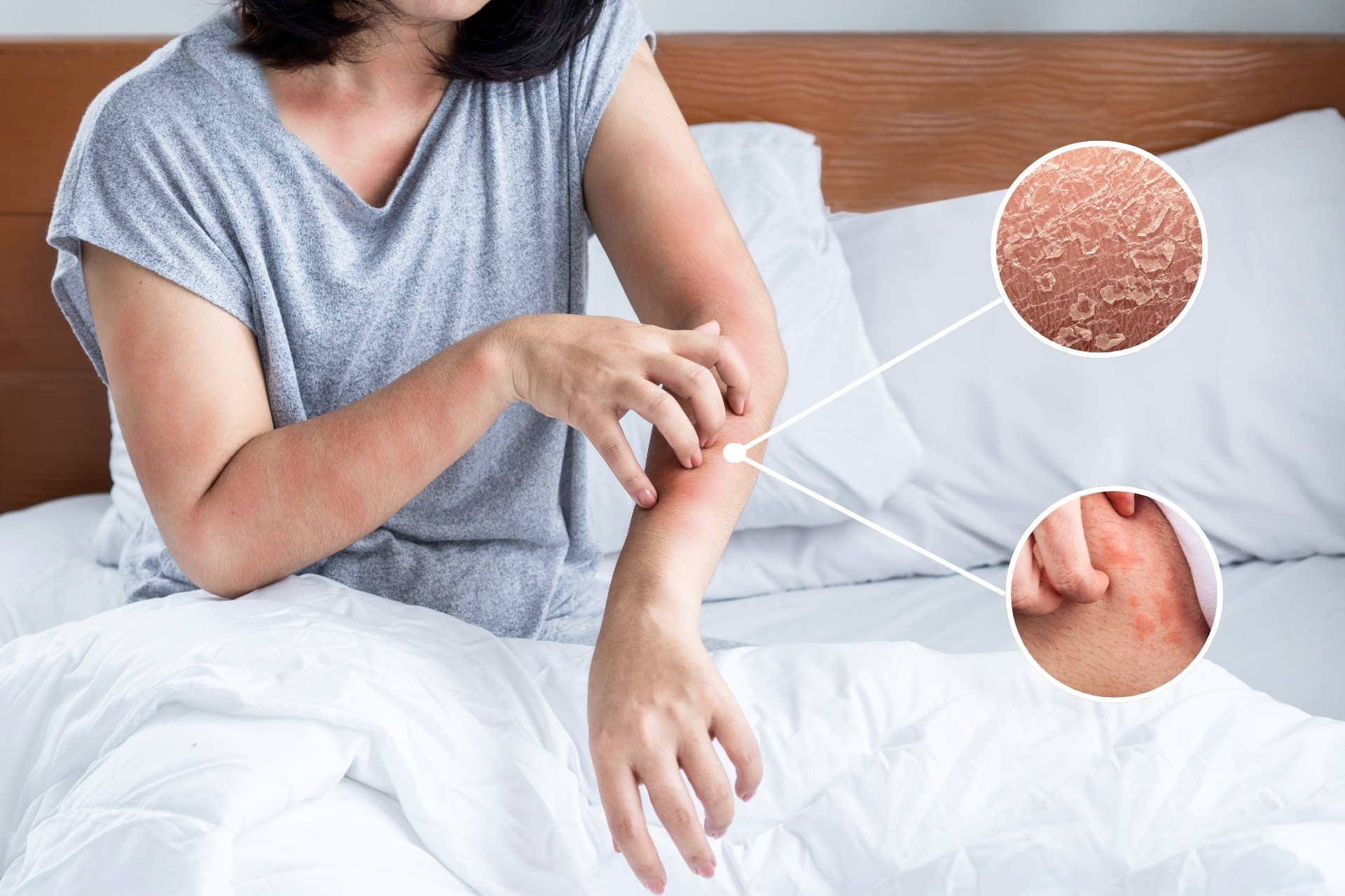 Khi hàng rào bảo vệ da suy yếu, da thường biểu hiện qua các triệu chứng như khô ráp, dễ ngứa, nổi mẩn đỏ, và cảm giác căng tức.
