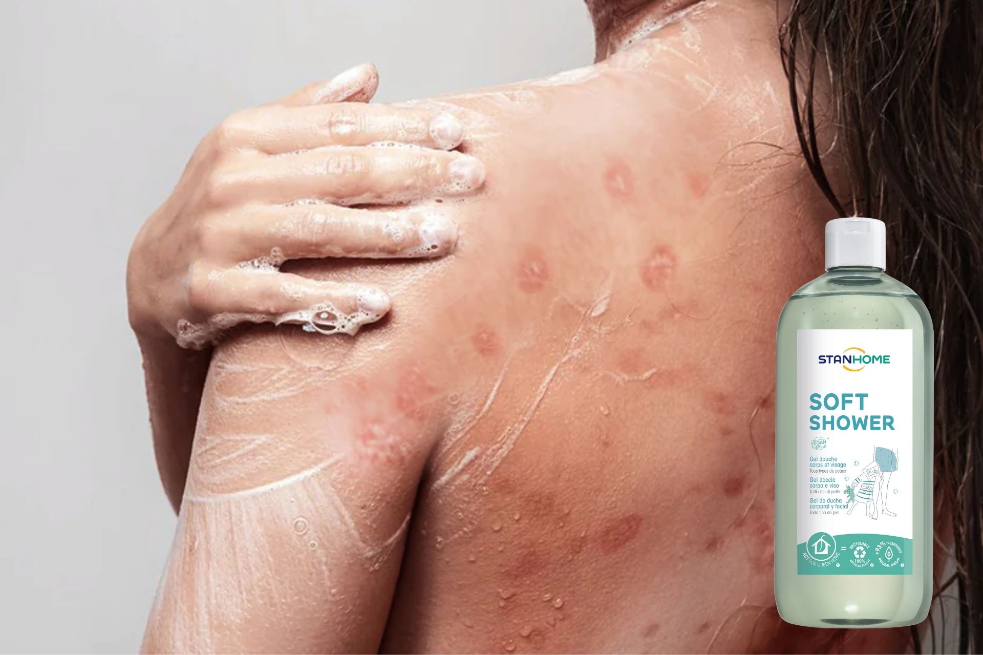 Làm sạch dịu nhẹ vảy nến các vùng da trên cơ thể