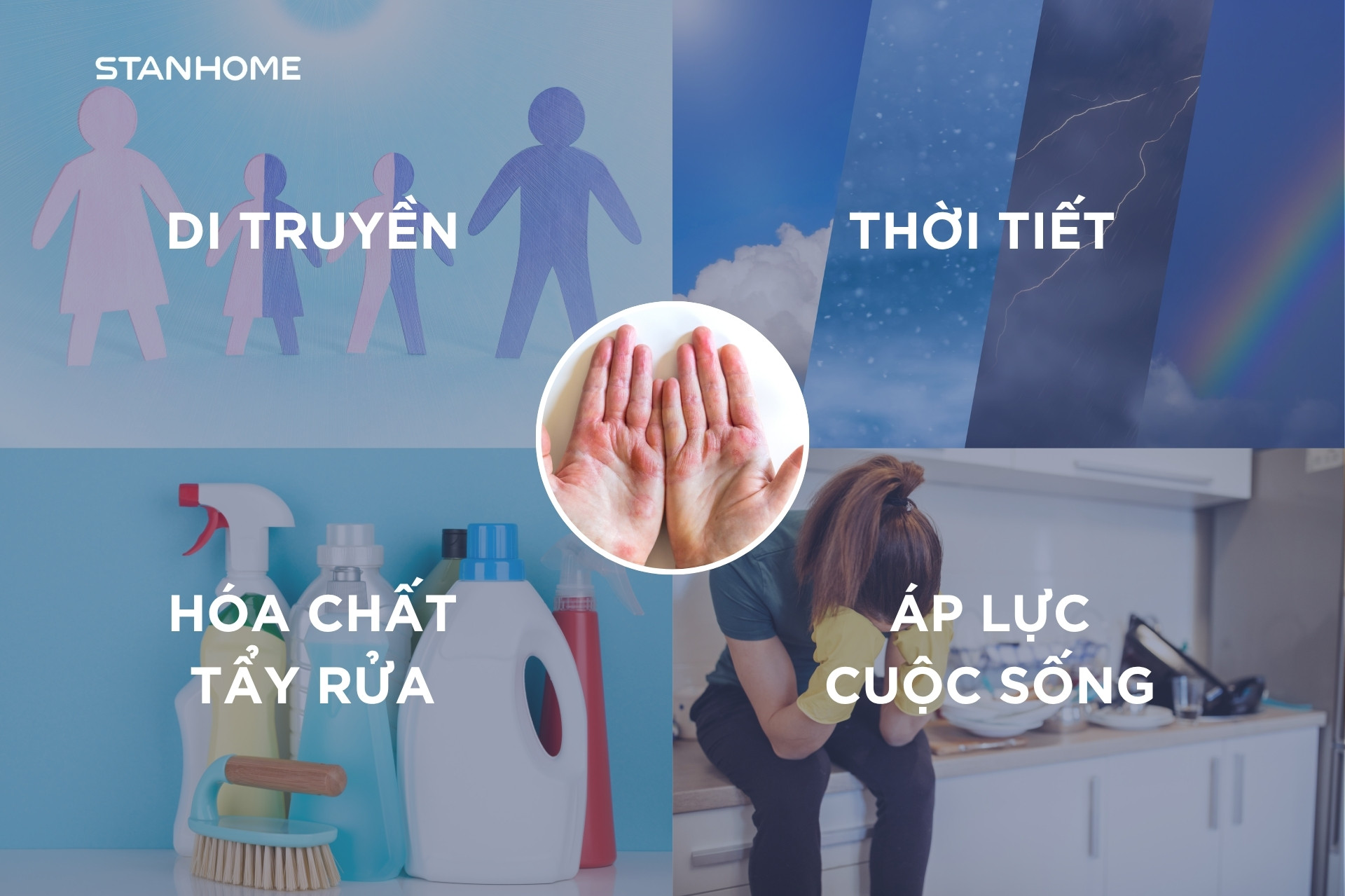 Có nhiều yếu tố khiến hàng rào bảo vệ da bị suy yếu, làm da dễ bị kích ứng và tổn thương.