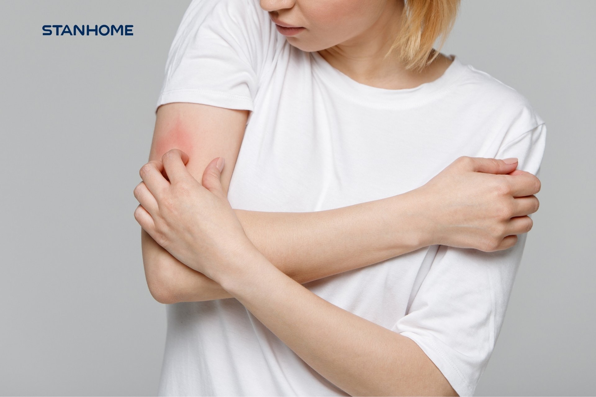 Ngứa là biểu hiện phổ biến nhất của viêm da cơ địa(eczema)