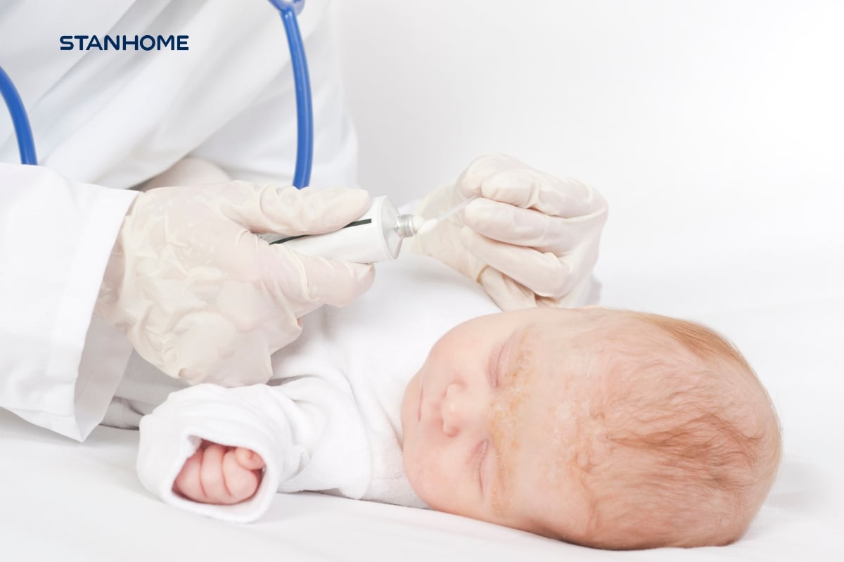 Thăm khám bác sĩ da liễu thường xuyên để điều trị và chăm sóc viêm da cơ địa cho trẻ