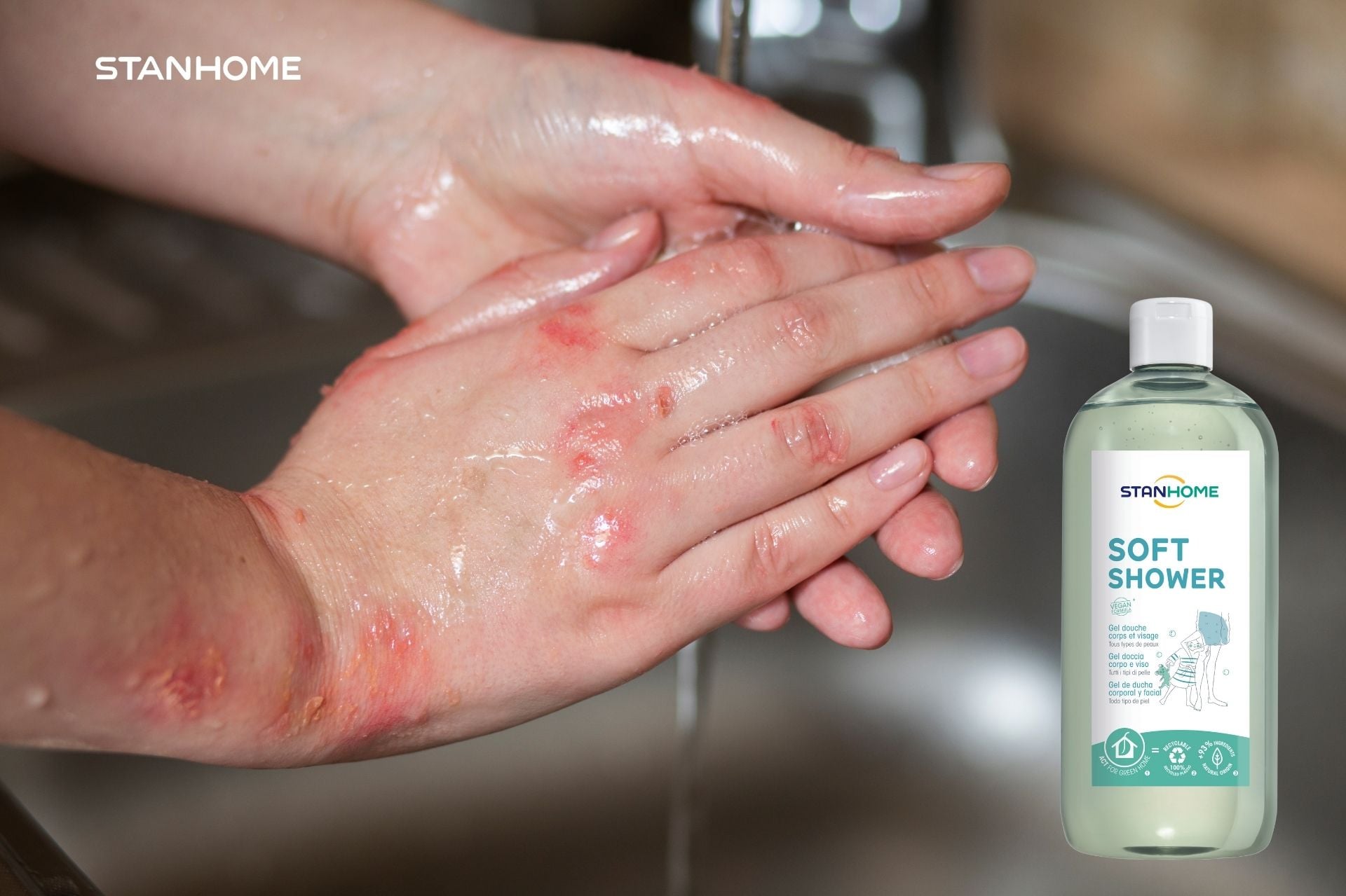 Làm sạch dịu nhẹ vảy nến các vùng da trên cơ thể