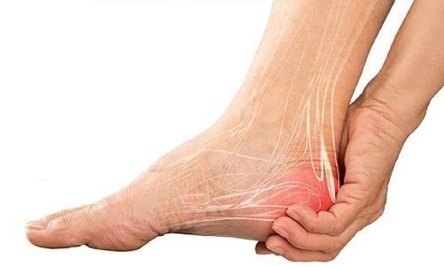 Đau gót chân có thể do tình trạng viêm nhiễm gây ra