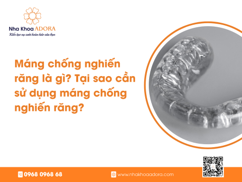 Máng Chống Nghiến Răng – Giải Pháp Hiệu Quả Bảo Vệ Răng Miệng