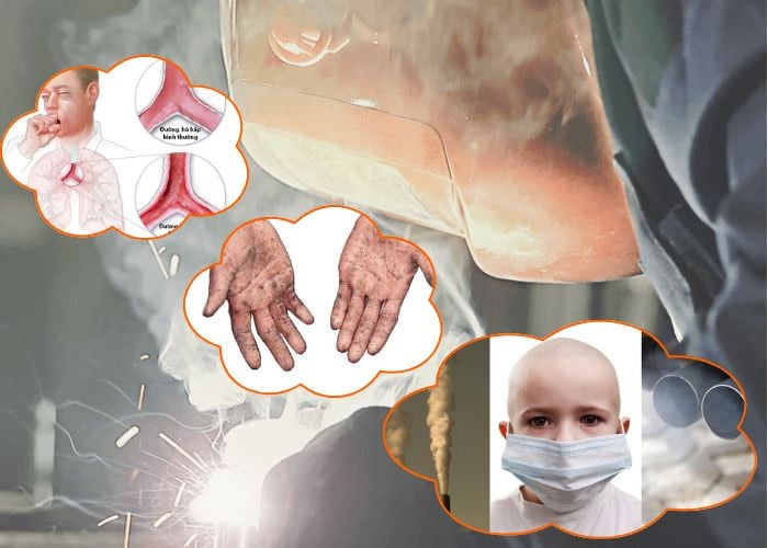Những tác hại nguy hiểm từ khói hàn thiếc gây ra