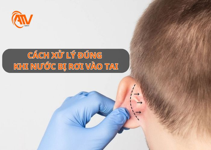 Xử lý khi bị nước vô tai