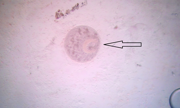 Bệnh do trùng quả dưa gây ra ở cá koi