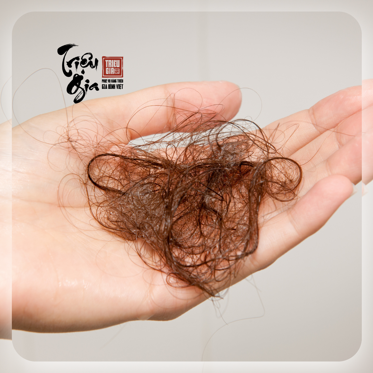 Rụng tóc nhiều: Nguyên nhân và biện pháp giảm rụng tóc tại nhà