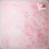 Trị rôm sảy bằng lá trầu không - Giải pháp an toàn và hiệu quả