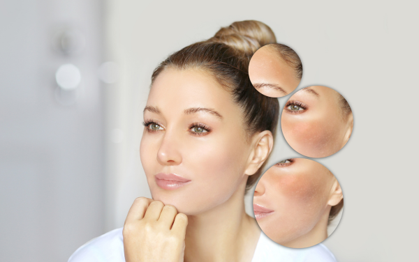 Công dụng của probiotic nổi trội chính là củng cố hàng rào bảo vệ da