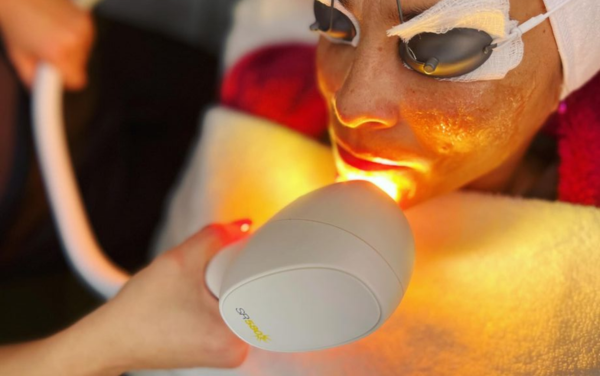 Người bị mụn có nên xông mặt không, hoàn toàn không nếu da vừa xâm lấn