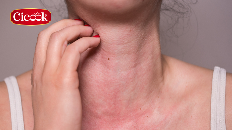 Mật ong có thể gây dị ứng